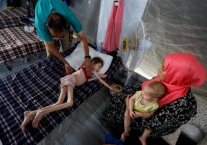 18 وفاة خلال 24 ساعة بسبب الجوع في غزة